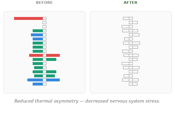Spinal Thermography Nerve Scans before and after NetworkSpinal Care.